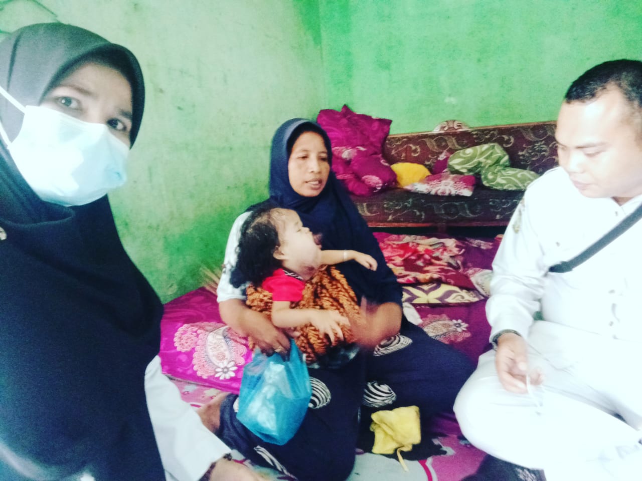 Aliza, Bocah Berusia 22 Bulan Penderita Tumor Mandibula Dextra